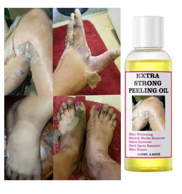 Skin peeling oil and dead skin removal