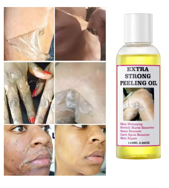 Skin peeling oil and dead skin removal